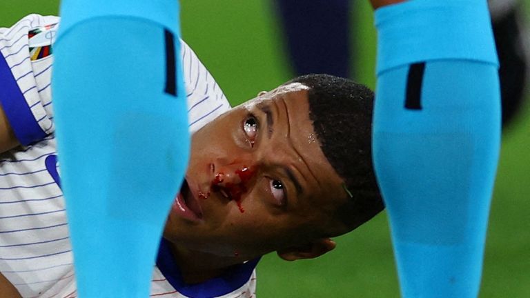 Depay